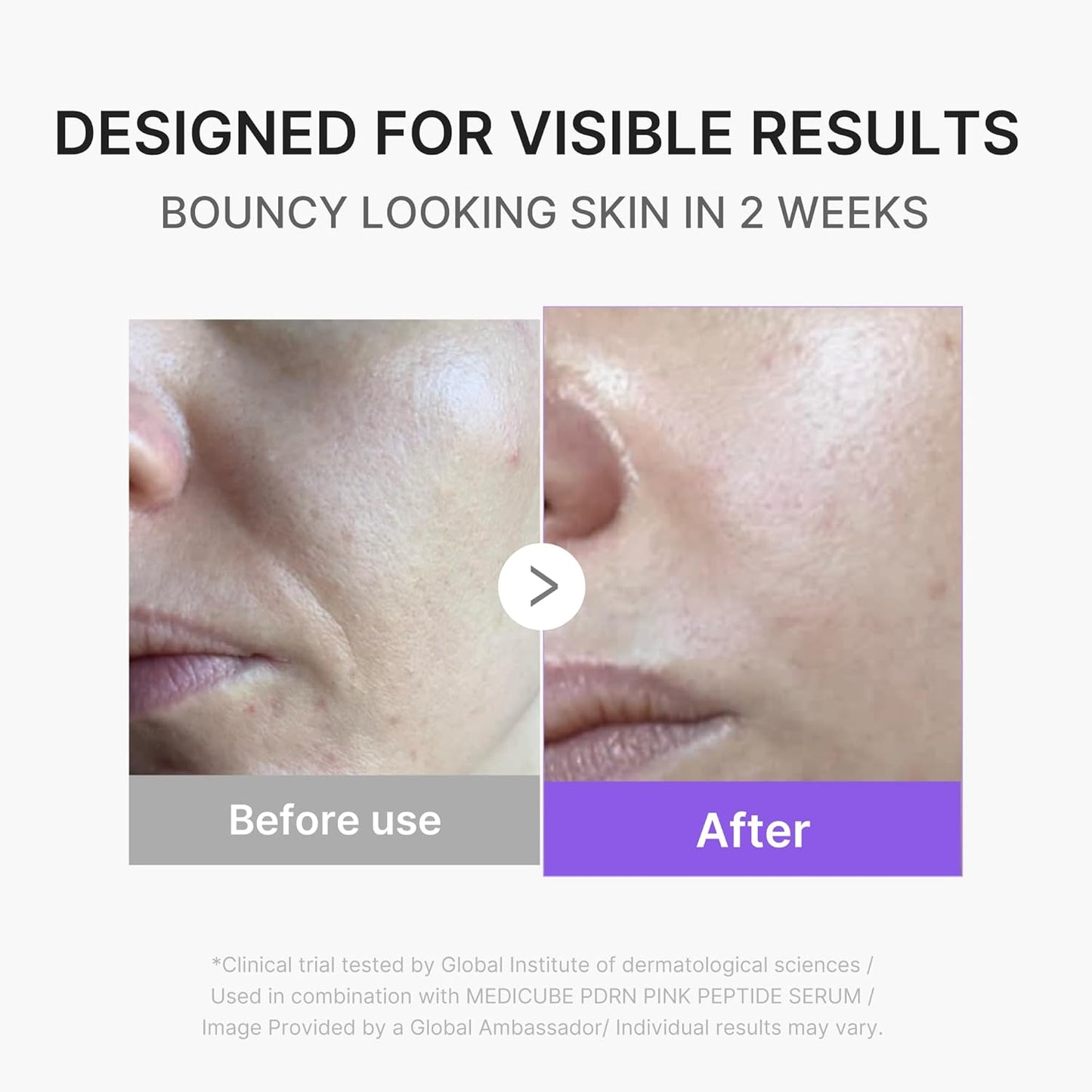 medicube Mini Booster Pro Plus - Juego de dispositivos faciales com...