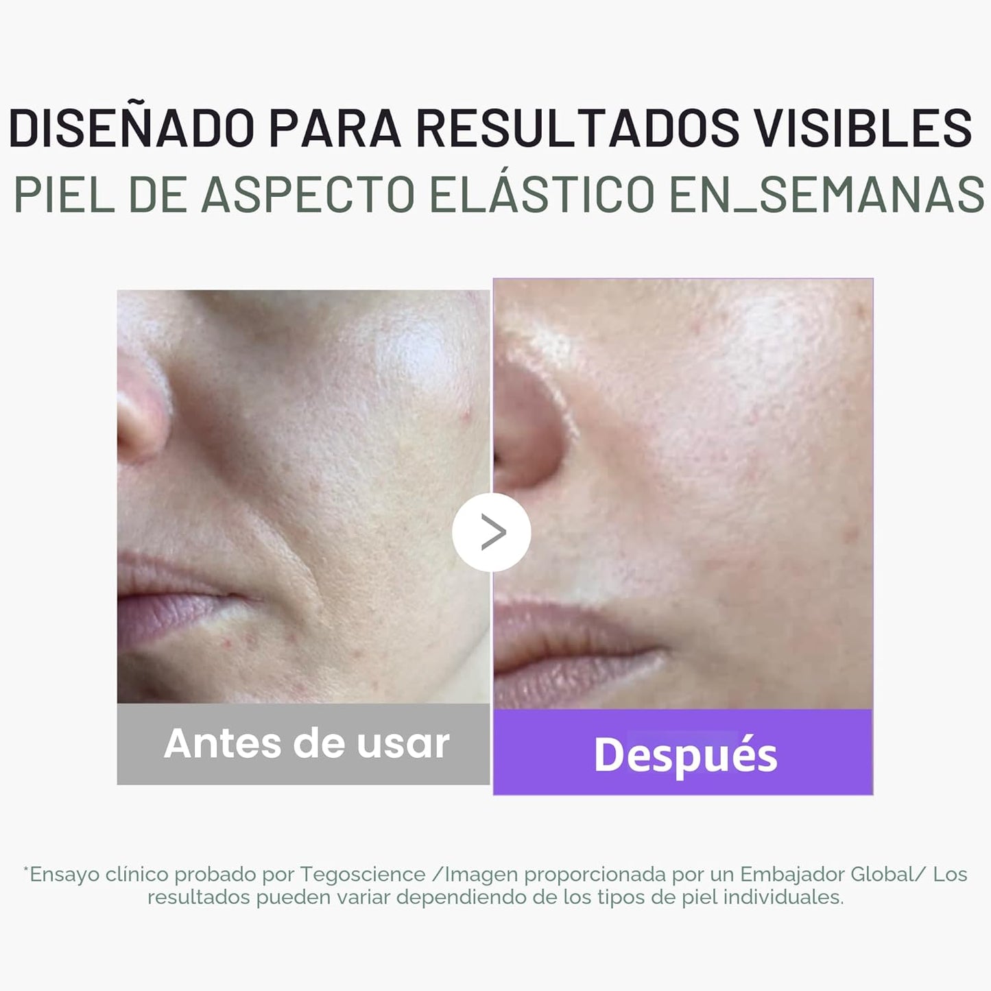 medicube Mini Booster Pro Plus - Juego de dispositivos faciales com...