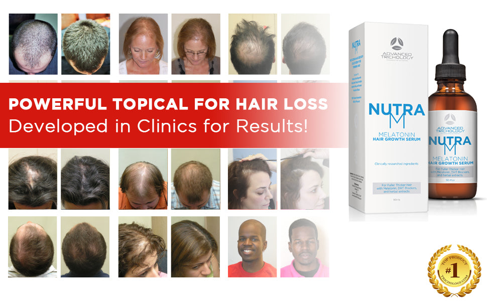 NutraM Suero para el crecimiento del cabello – Dermatológicamente probado, aprobado* por la American Hair Loss Association | Bloqueador DHT del cuero cabelludo para adelgazamiento del cabello hombres