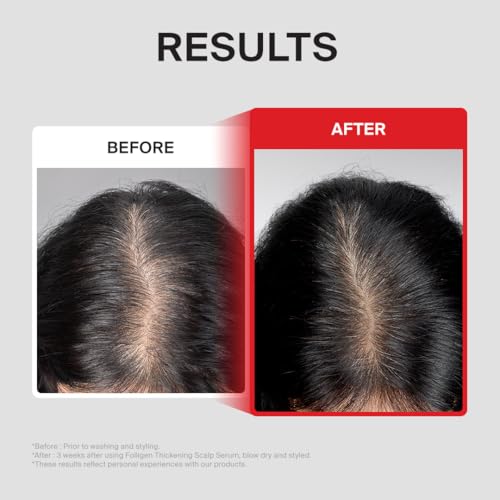 Dr.FORHAIR Folligen - Exfoliante de sal marina y suero para el cuer...