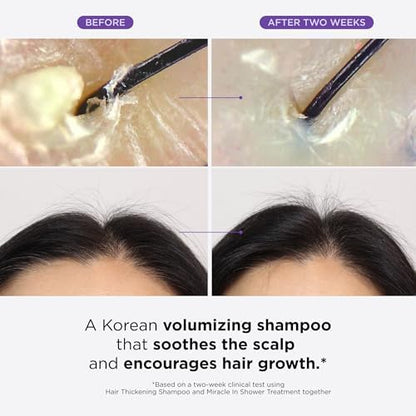 Dr. Groot Champú para engrosar el cabello, cuidado coreano del cabello con biotina, aceite de romero para ayudar a dar volumen al adelgazamiento, el cabello dañado, hidratar el cabello y el cuero