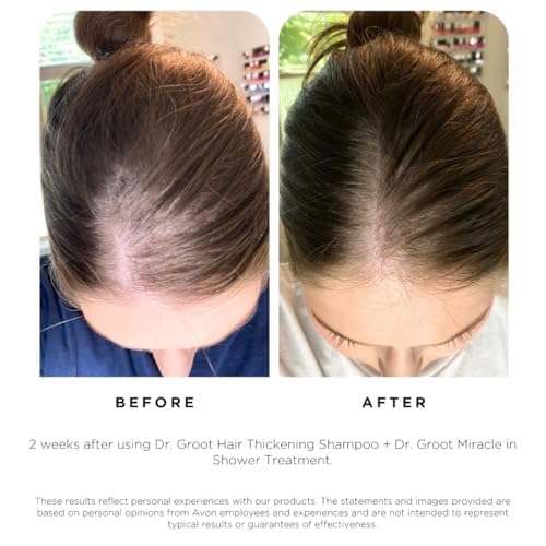 Dr. Groot Champú para engrosar el cabello, cuidado coreano del cabello con biotina, aceite de romero para ayudar a dar volumen al adelgazamiento, el cabello dañado, hidratar el cabello y el cuero