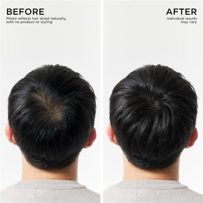 Dr. Groot Champú para engrosar el cabello, cuidado coreano del cabello con biotina, aceite de romero para ayudar a dar volumen al adelgazamiento, el cabello dañado, hidratar el cabello y el cuero