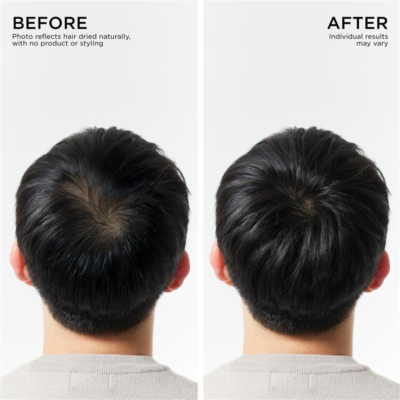 Acondicionador para engrosar el cabello de Dr. Groot para la pérdida del cabello, cabello delgado, cuidado capilar coreano, tratamiento del cuero cabelludo con biotina, clínicamente probado, cabello