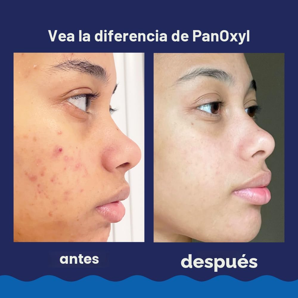 PanOxyl Lavado de espuma para acné con peróxido de benzoilo al 10%,...