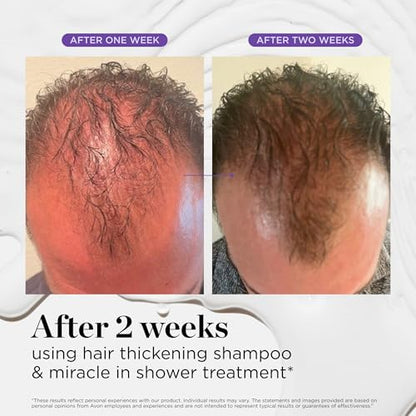 Dr. Groot Champú para engrosar el cabello, cuidado coreano del cabello con biotina, aceite de romero para ayudar a dar volumen al adelgazamiento, el cabello dañado, hidratar el cabello y el cuero