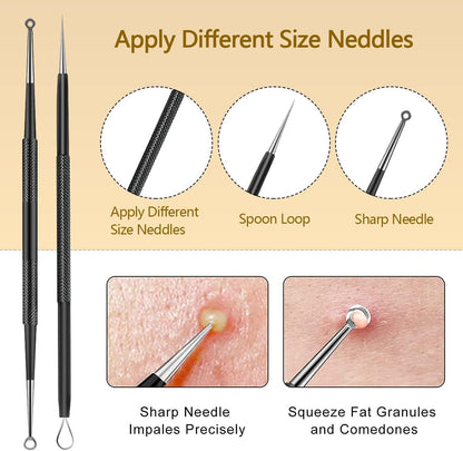 Kit de herramientas de acero inoxidable para eliminar puntos negros...