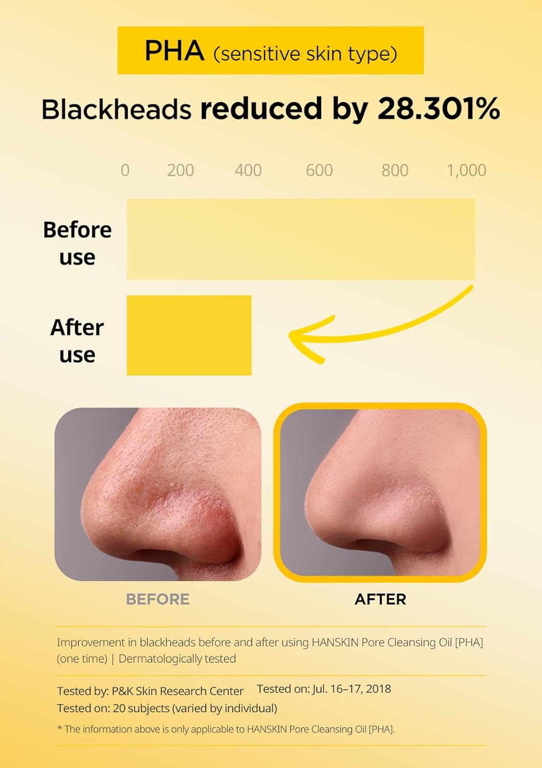 Hanskin K-Beauty - Aceite limpiador PHA (6.76 onzas) y espuma limpiadora | Eliminación de puntos negros, exfoliación suave y cuidado de poros para pieles grasas, propensas al acné y mixtas, juego