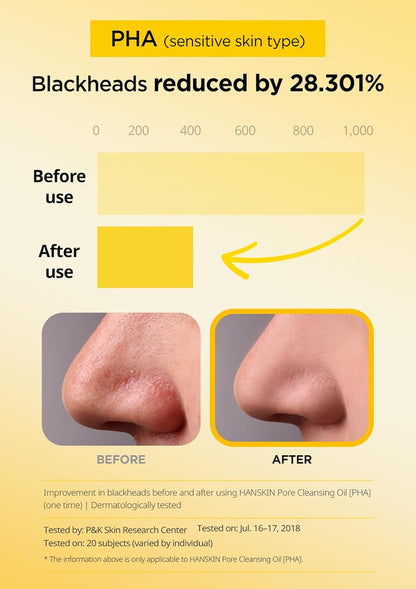 Hanskin K-Beauty - Aceite limpiador PHA (6.76 onzas) y espuma limpiadora | Eliminación de puntos negros, exfoliación suave y cuidado de poros para pieles grasas, propensas al acné y mixtas, juego