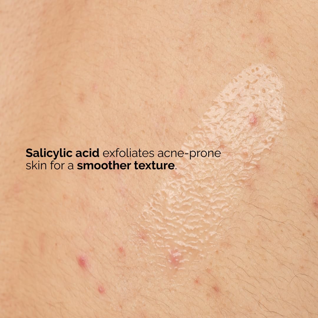 The Ordinary Suero corporal de ácido salicílico al 0.5%, tratamiento exfoliante para piel propensa al acné, 8.1 onzas líquidas