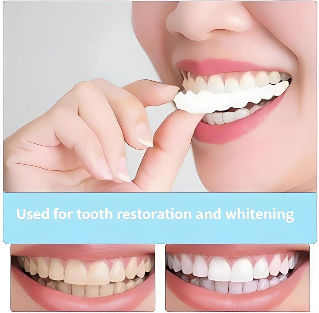 2 Pairs Temporary Smile Support Adjustable, Suitable for All Sexes,...
