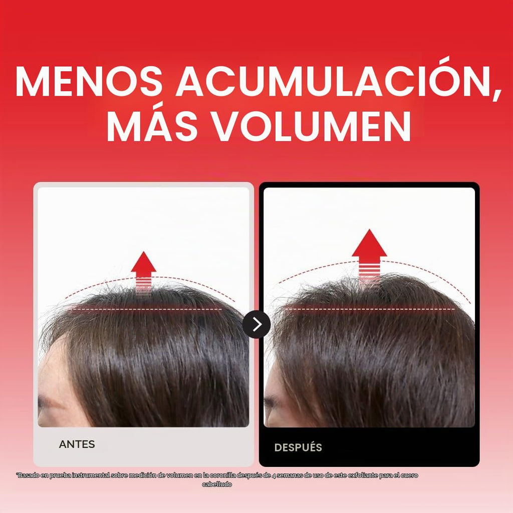 Dr.FORHAIR Folligen - Exfoliante de sal marina y suero para el cuer...