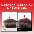 Dr.FORHAIR Folligen - Exfoliante de sal marina y suero para el cuer...