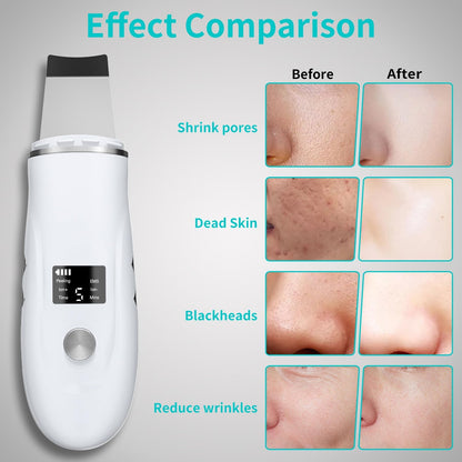 Espátula facial para depurar la piel - Herramienta de limpieza prof...