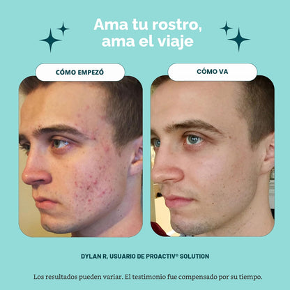Kit completo de 90 días de cuidado de la piel para acné Proactiv de...