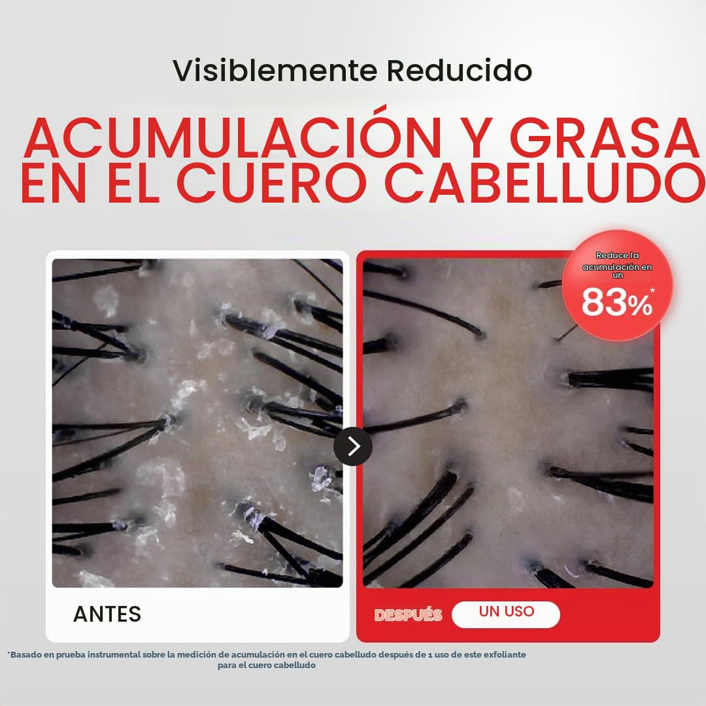 Dr.FORHAIR Folligen - Exfoliante de sal marina y suero para el cuer...