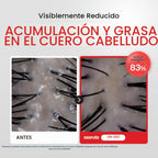 Dr.FORHAIR Folligen - Exfoliante de sal marina y suero para el cuer...