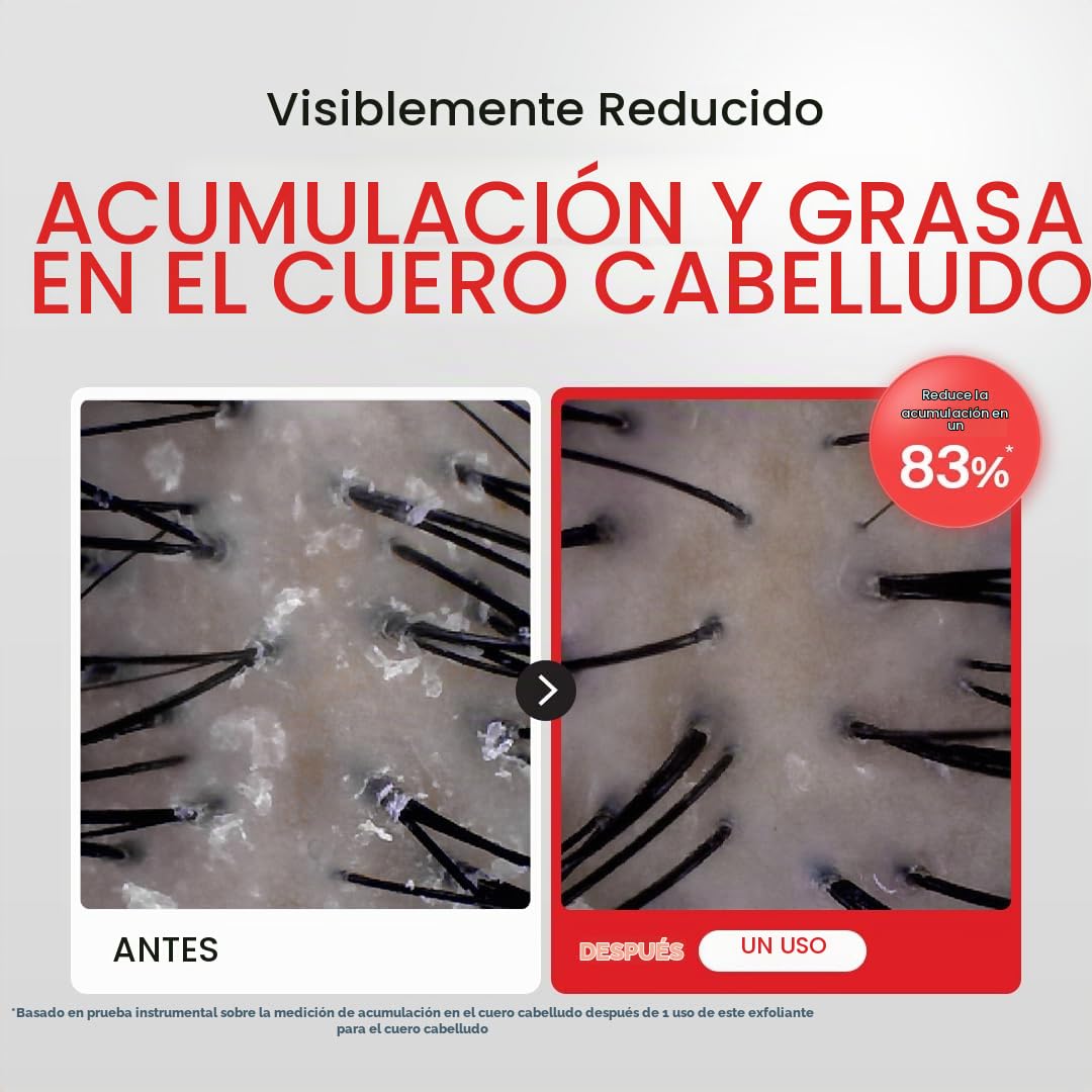 Dr.FORHAIR Folligen - Exfoliante de sal marina y suero para el cuer...