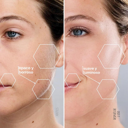 Michael Todd Beauty Sonicsmooth Dermaplane - Maquinilla de afeitar...