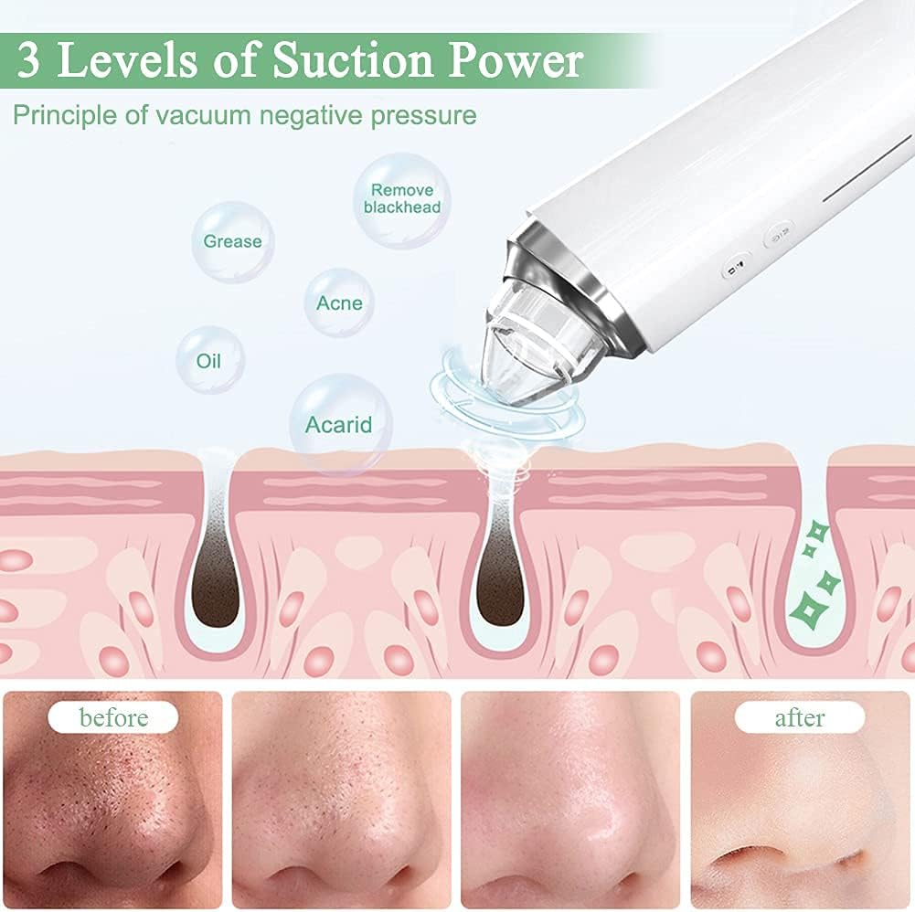 Aspirador de poros para eliminar puntos negros, limpiador facial vi...