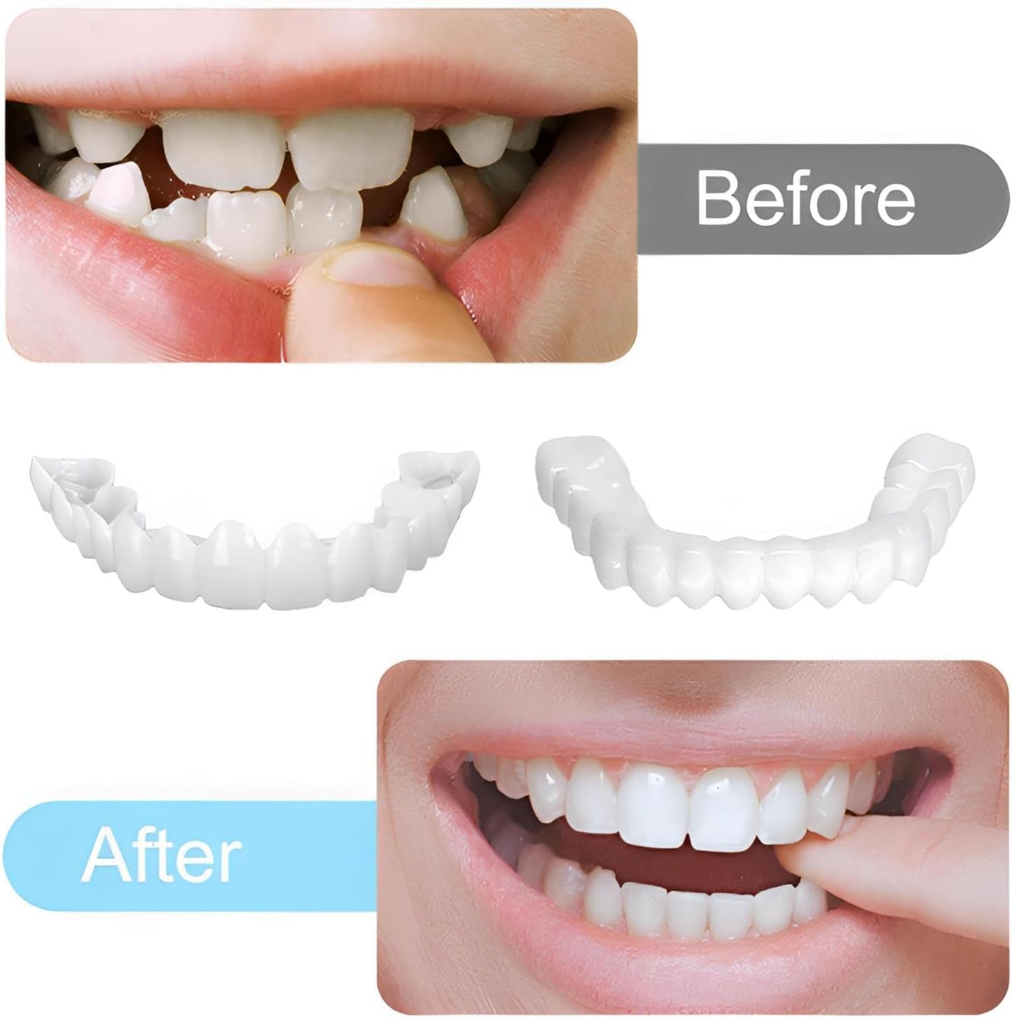 2 Pairs Temporary Smile Support Adjustable, Suitable for All Sexes,...