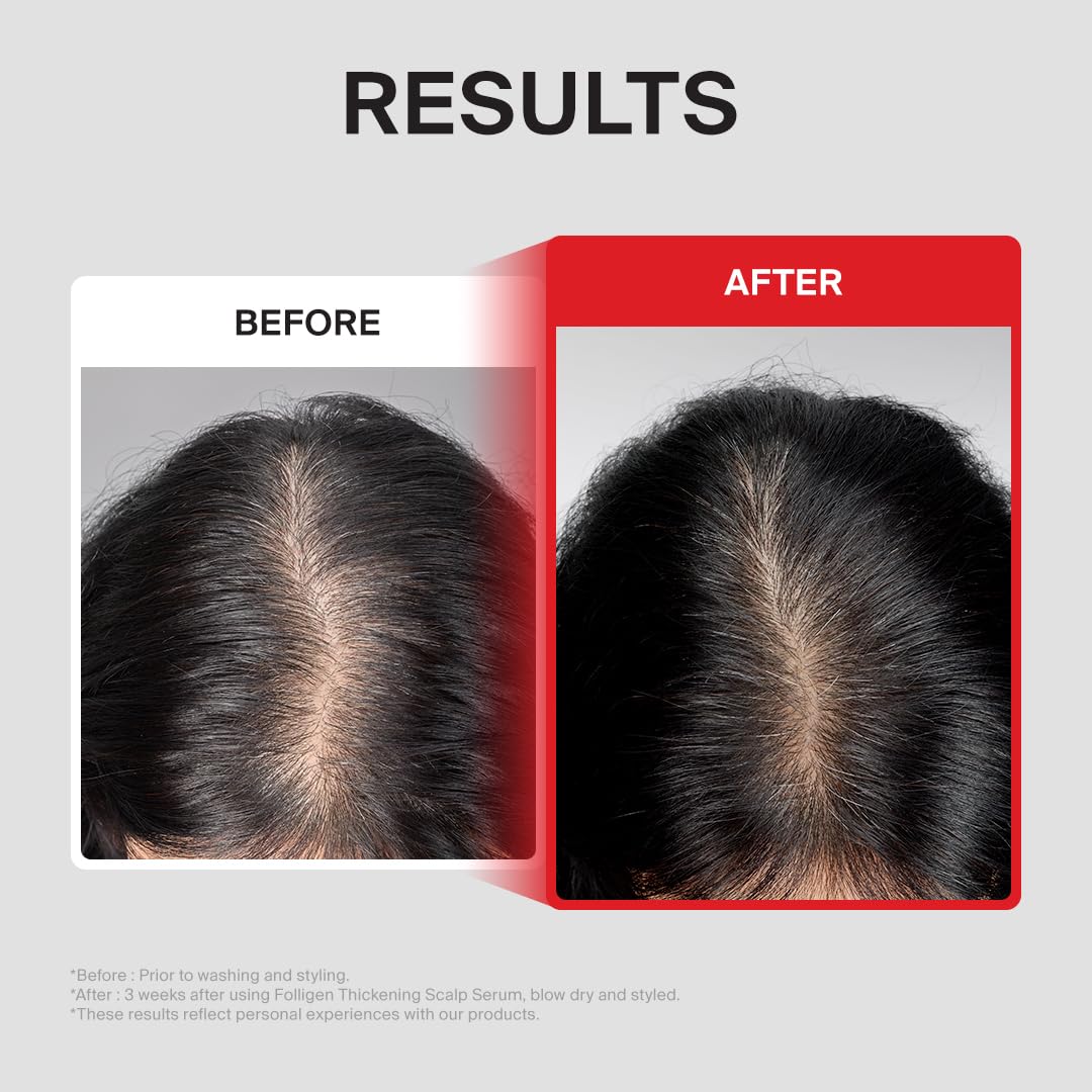 Dr.FORHAIR Folligen - Suero espesante para el cuero cabelludo, 1.7...