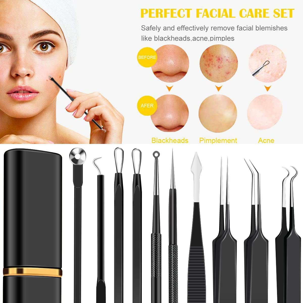 Kit de herramientas de acero inoxidable para eliminar puntos negros...