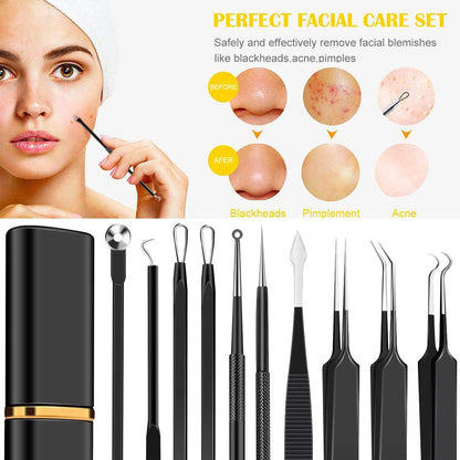 Kit de herramientas de acero inoxidable para eliminar puntos negros...