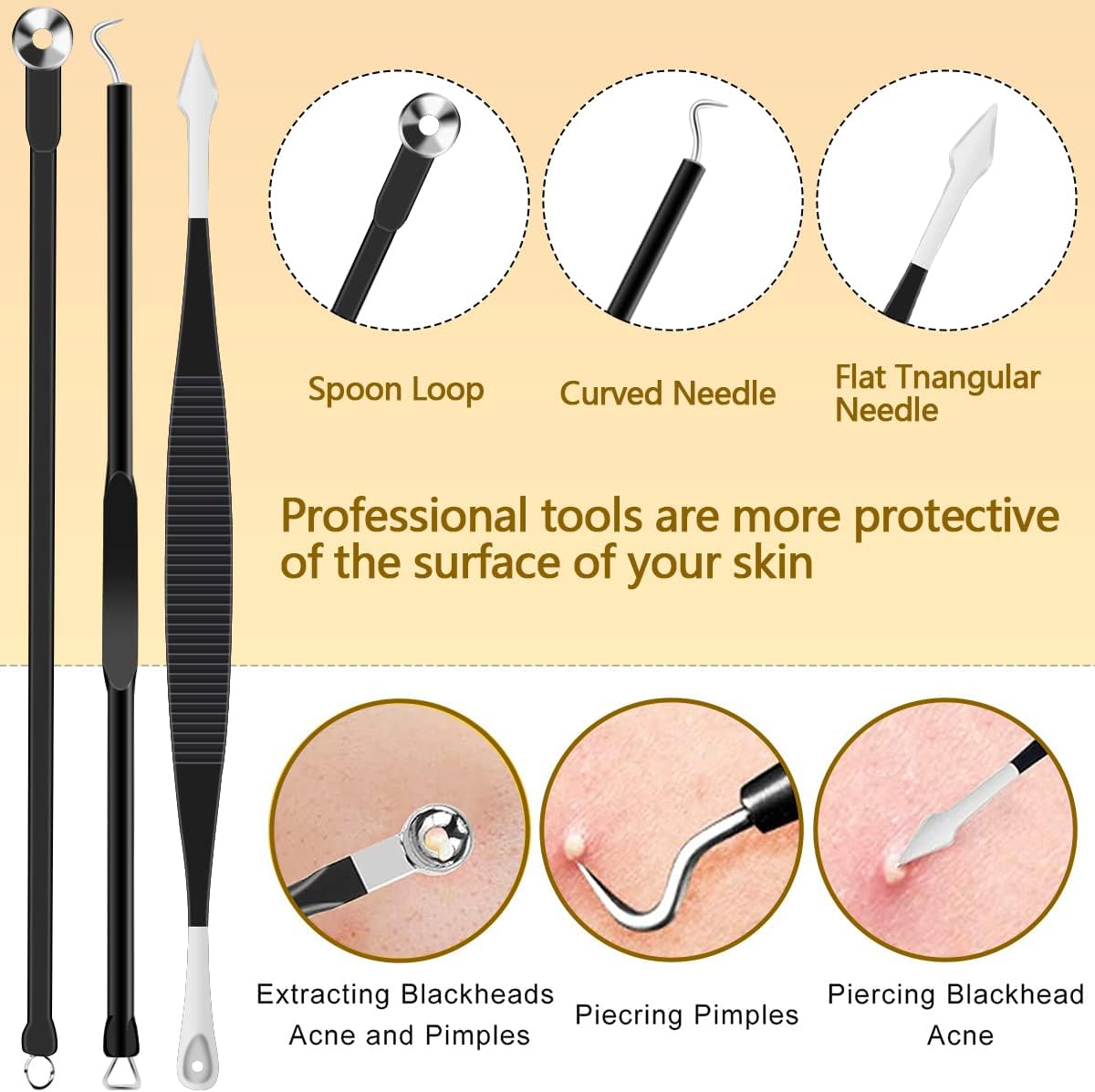 Kit de herramientas de acero inoxidable para eliminar puntos negros...