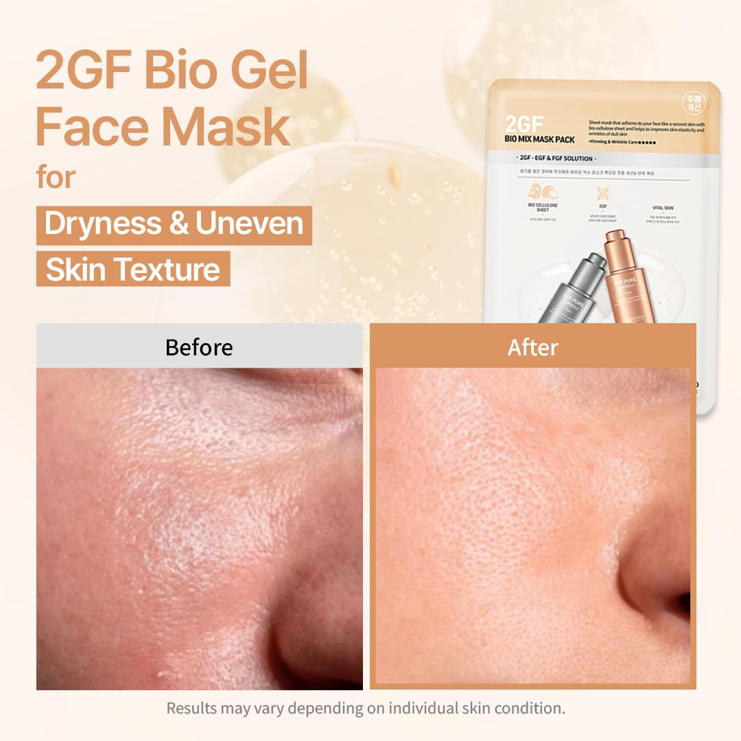 SWANICOCO Mascarilla facial de bio gel 2GF segura para embarazo, el...
