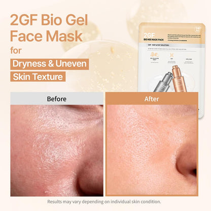 SWANICOCO Mascarilla facial de bio gel 2GF segura para embarazo, el...