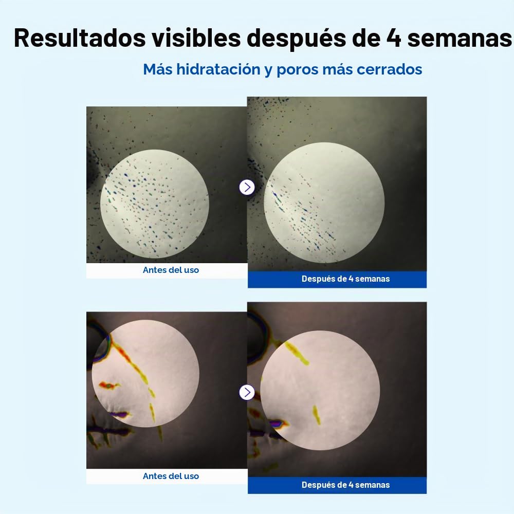 Crema hidratante definitiva NIDA Youthful Formula™ | Centella Asiát...