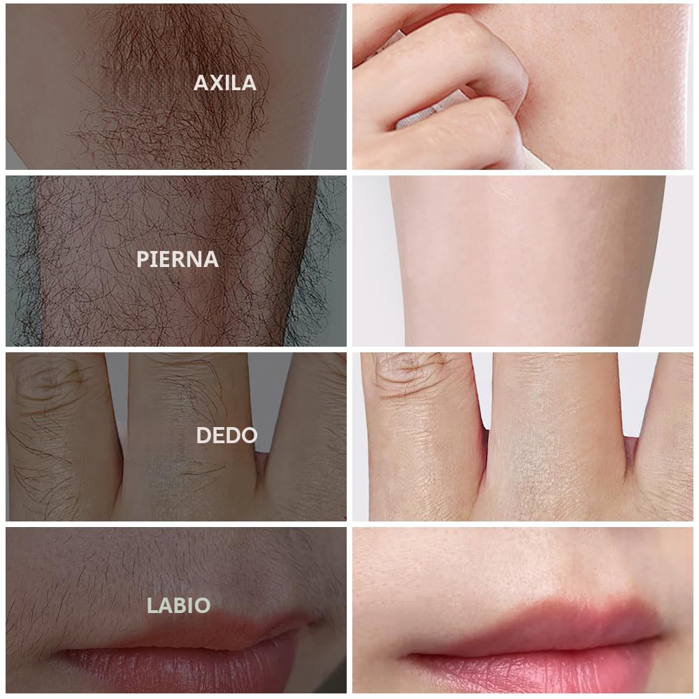 PHOFAY Crema depilatoria para hombres y mujeres, piel sensible, de...