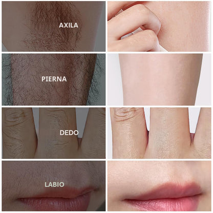 PHOFAY Crema depilatoria para hombres y mujeres, piel sensible, de...