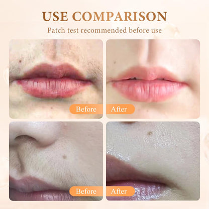 Crema depilatoria facial para mujeres, 2026 nueva crema facial depi...
