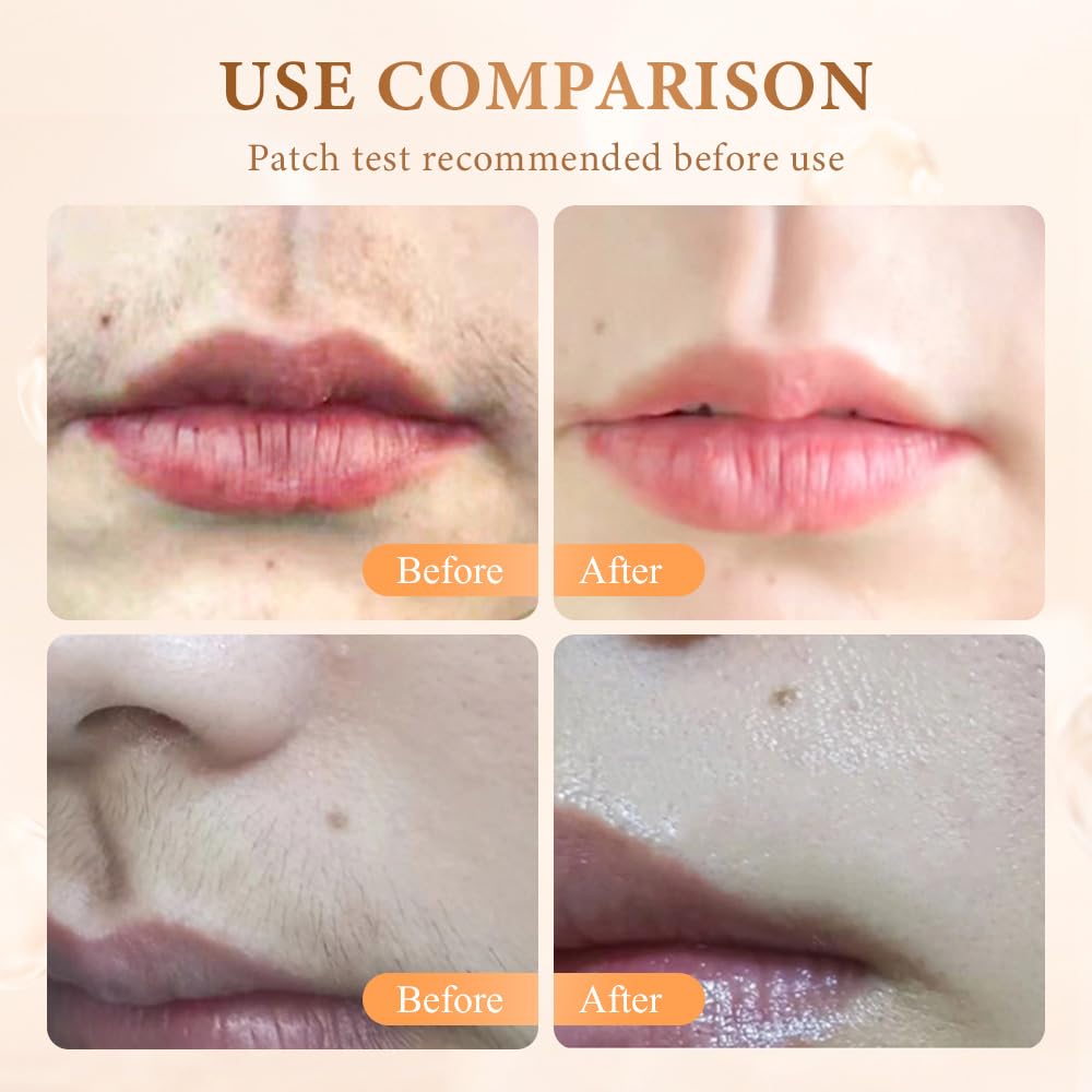 Crema depilatoria facial para mujeres, 2026 nueva crema facial depi...