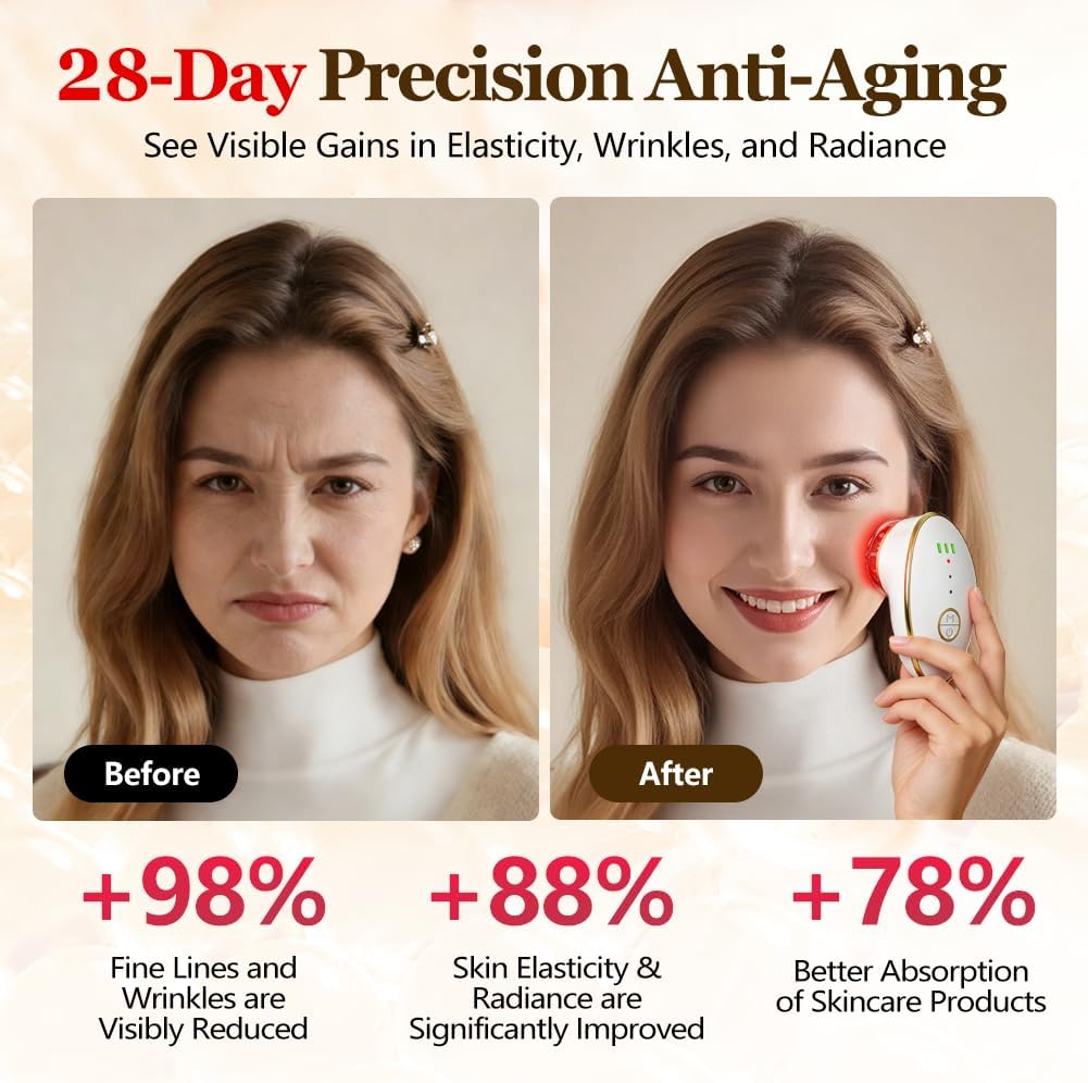 Juego de ventosas faciales para cara, dispositivo facial de microco...