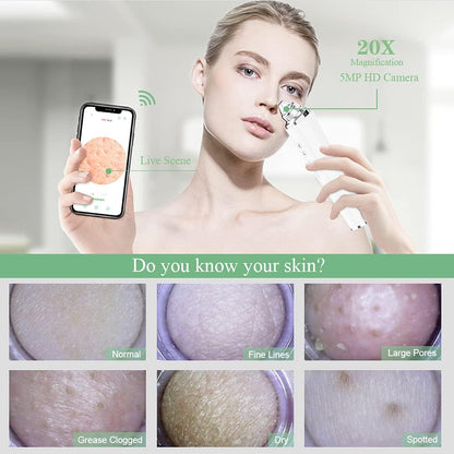 Aspirador de poros para eliminar puntos negros, limpiador facial vi...