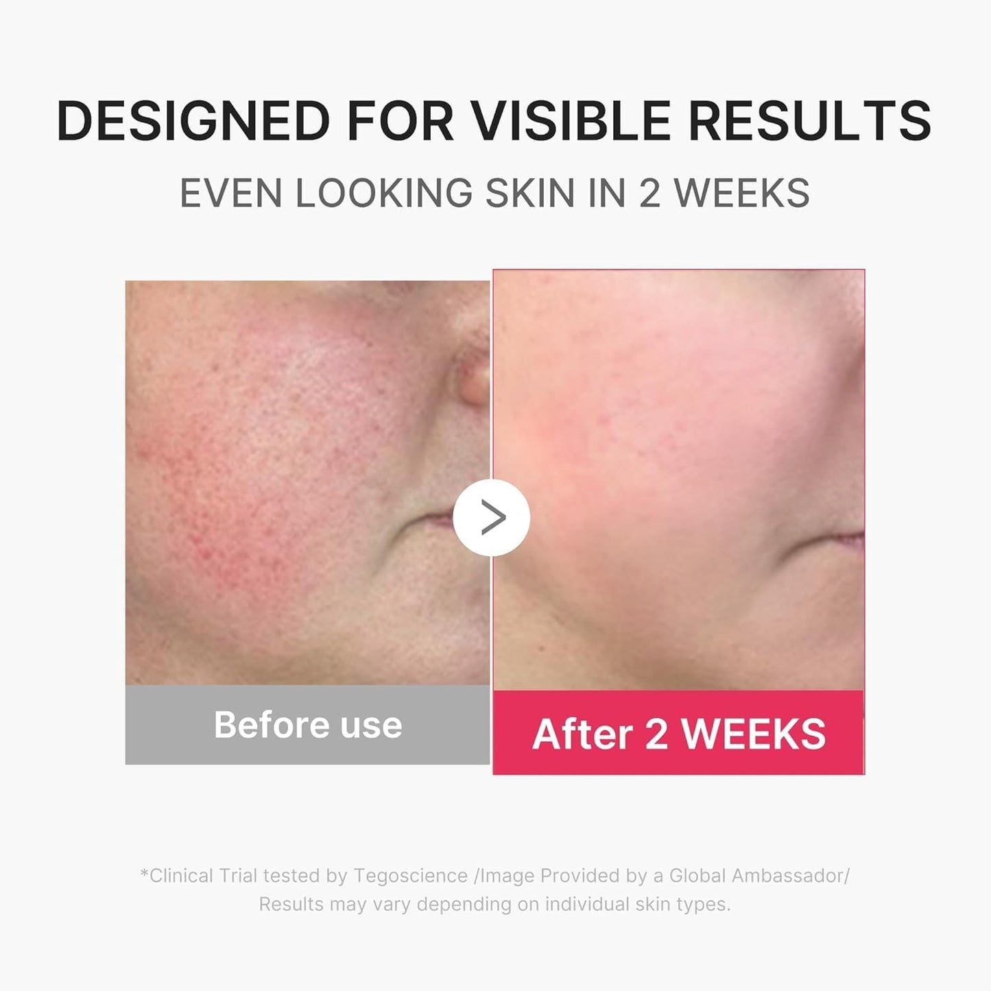medicube Booster Pro Mini Plus | Dispositivo facial para luminosida...