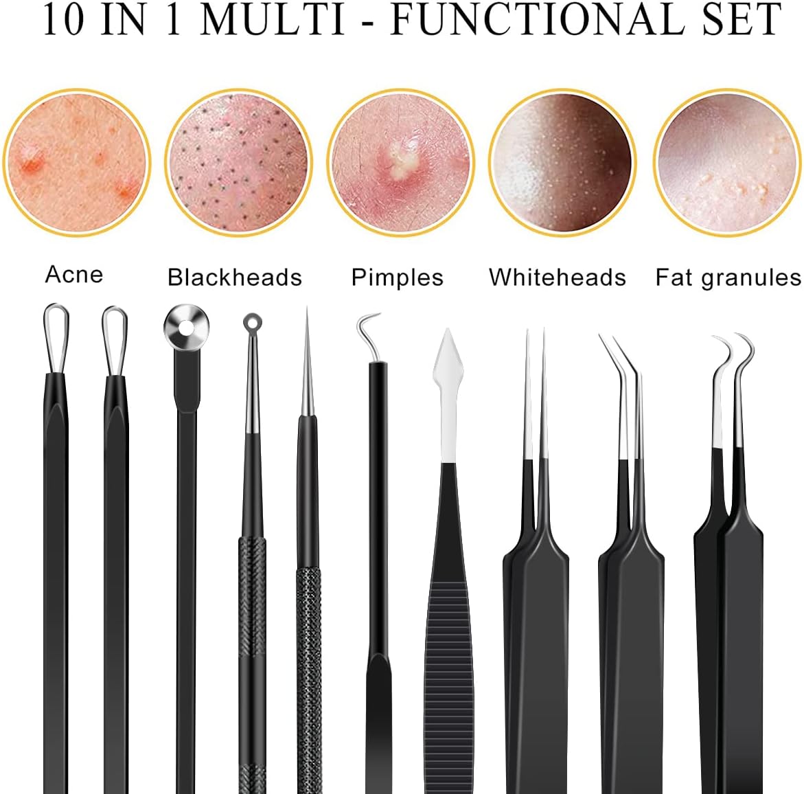 Kit de herramientas de acero inoxidable para eliminar puntos negros...