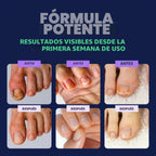 Orivelle Lápiz de Cuidado de Uñas del Pie - Remedio de Uñas de los...