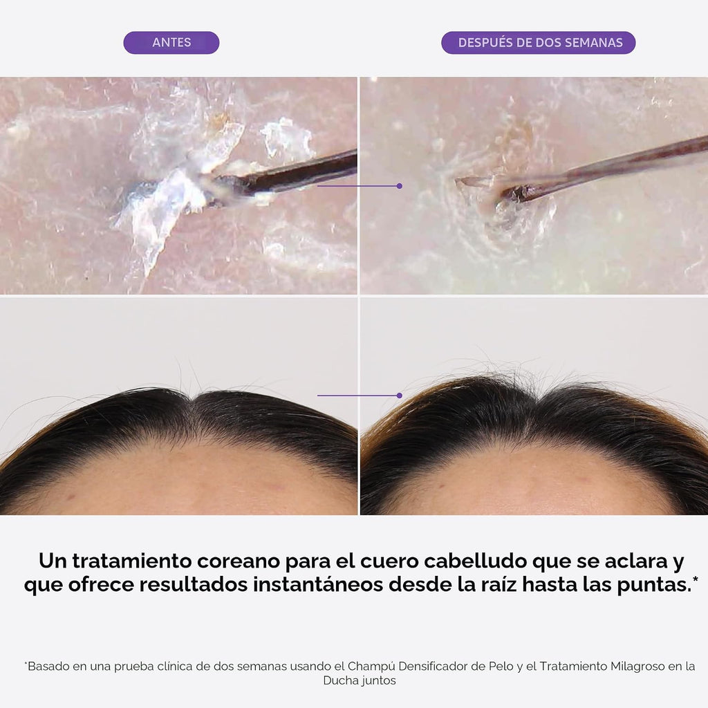Dr. Groot Set de champú espesante y tratamiento del cuero cabelludo...