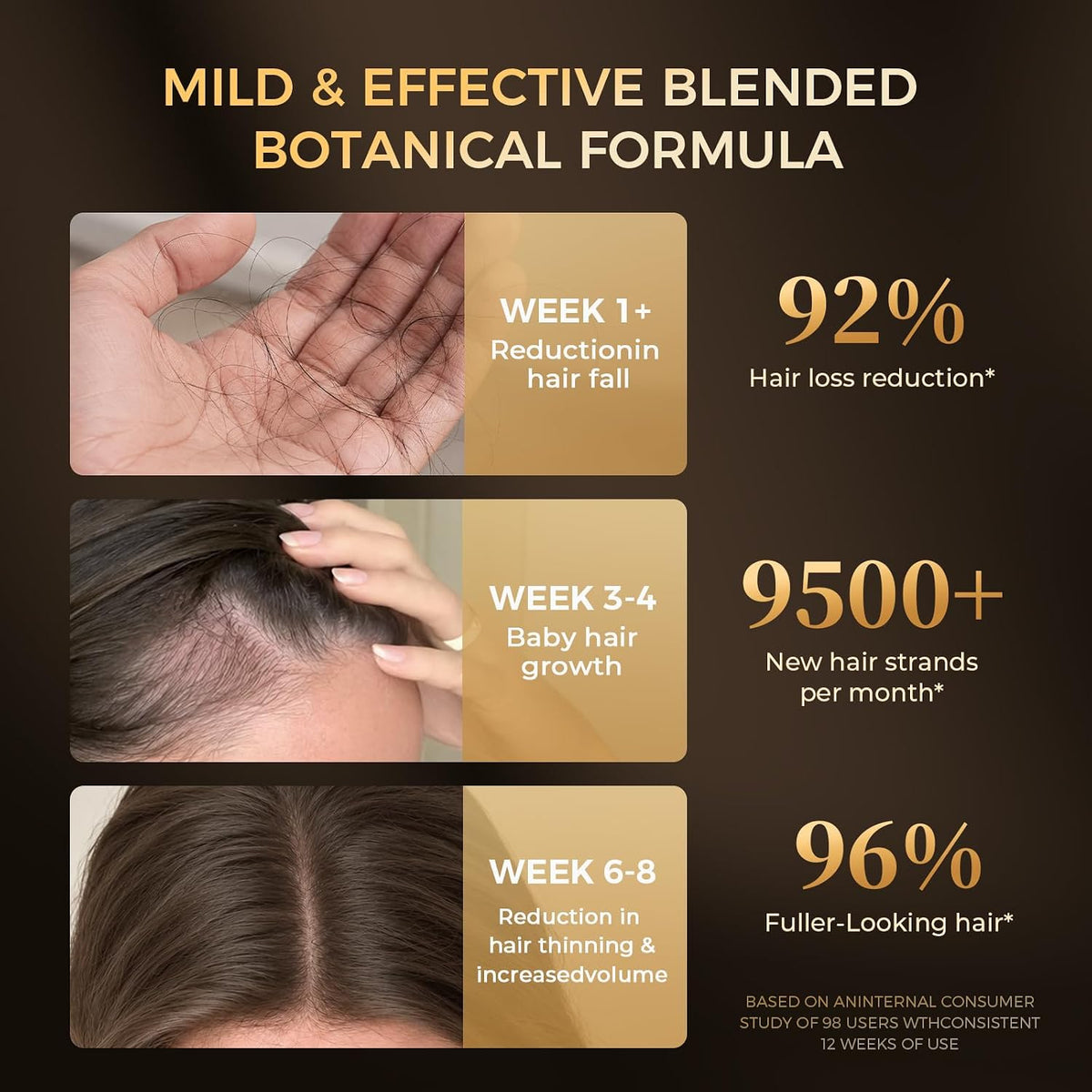 Biysber Suero natural para el crecimiento del cabello y el cuero ca...