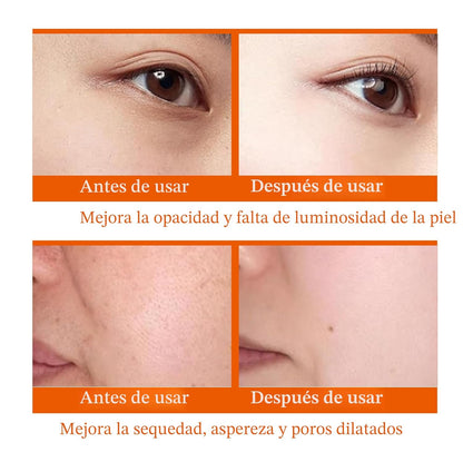 Juego de 6 piezas para el cuidado de la piel hidratante con vitamin...