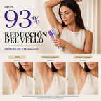 Skin Aurea Dispositivo de depilación láser IPL inalámbrico para muj...