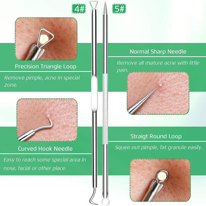 5 piezas de removedor de puntos negros, extractor de comedones, kit de pinzas curvas para puntos negros, kit de herramientas profesionales de acero inoxidable para eliminar espinillas, acné y manchas