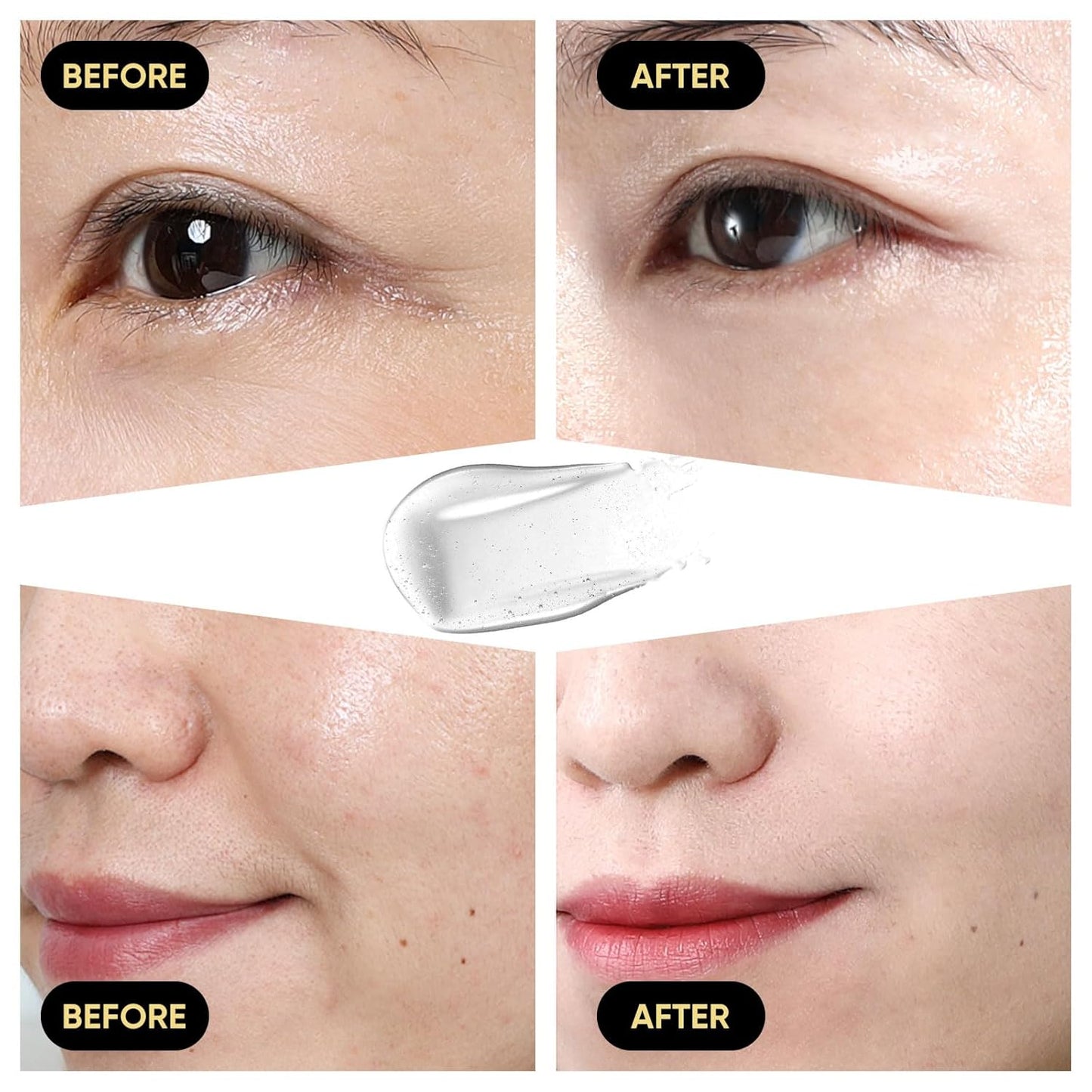 Esencia de suero de mucina de caracol, caracol avanzado 96% esencia de poder de mucina, suero facial para mujeres y hombres con filtrado de secreción de caracol, cuidado facial de la piel para