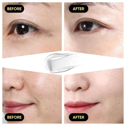 Esencia de suero de mucina de caracol, caracol avanzado 96% esencia de poder de mucina, suero facial para mujeres y hombres con filtrado de secreción de caracol, cuidado facial de la piel para