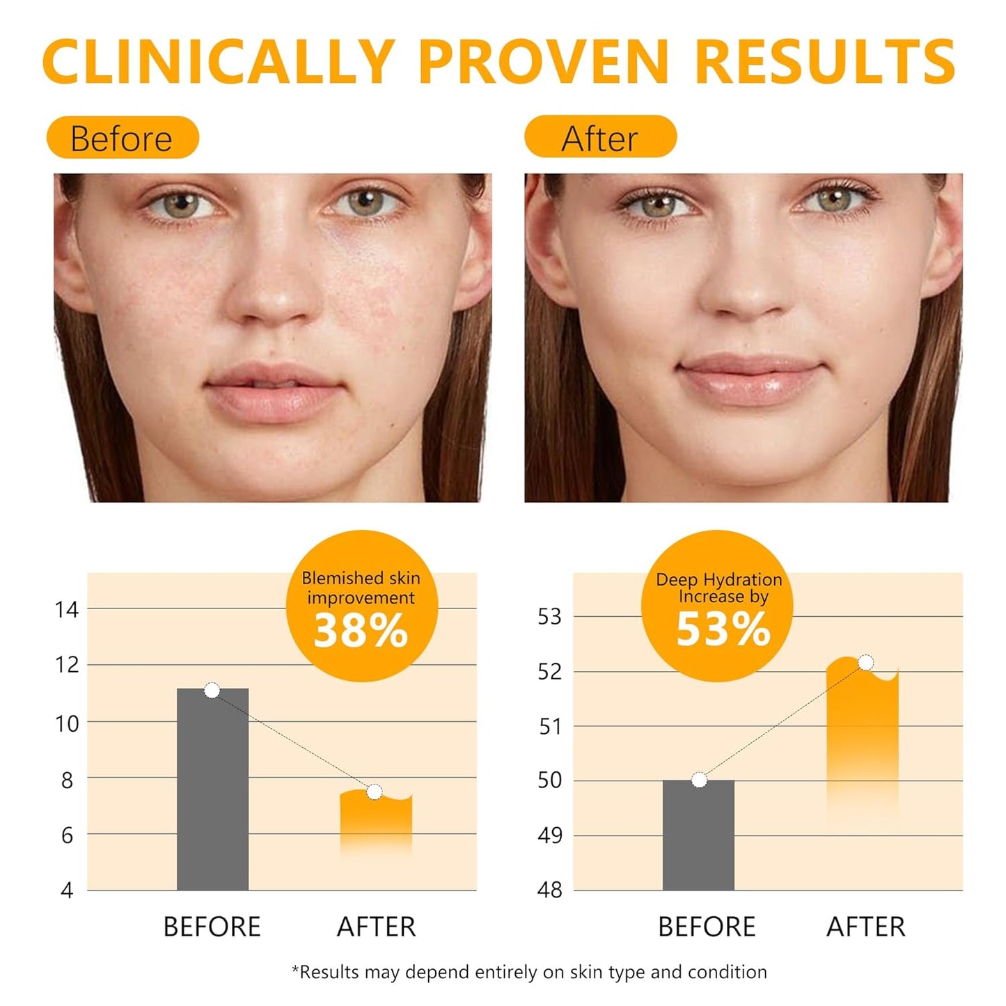 Suero relleno de mucina de caracol de alta concentración 3.4 fl oz 3.38 onzas líquidas, suero hidratante con caracol, reduce las arrugas y líneas finas, suaviza la piel facial