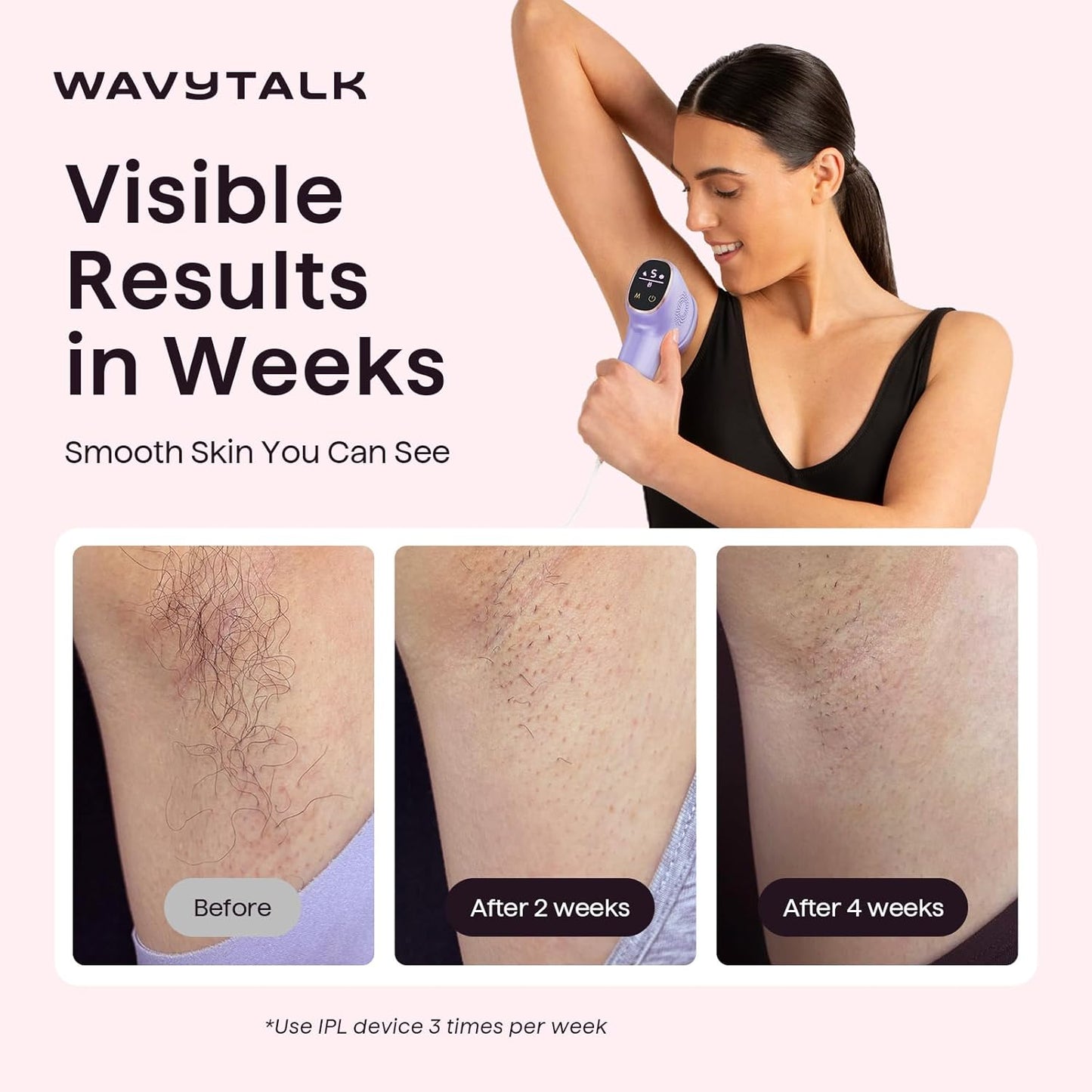 Wavytalk Dispositivo de depilación IPL, Bare It para bikini de cara...
